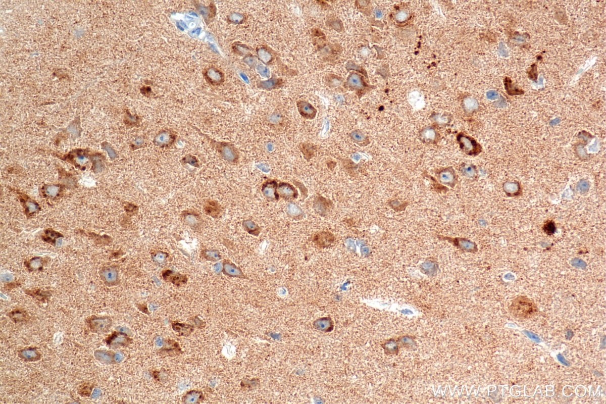 IHC staining of mouse brain using 85353-2-RR (same clone as 85353-2-PBS) Immunohistochemistry (IHC) staining of mouse brain tissue using CX3CL1 Recombinant monoclonal antibody (85353-2-RR)