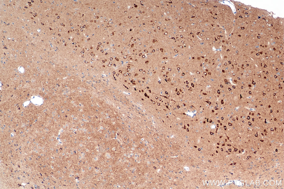 IHC staining of rat brain using 85353-2-RR (same clone as 85353-2-PBS) Immunohistochemistry (IHC) staining of rat brain tissue using CX3CL1 Recombinant monoclonal antibody (85353-2-RR)