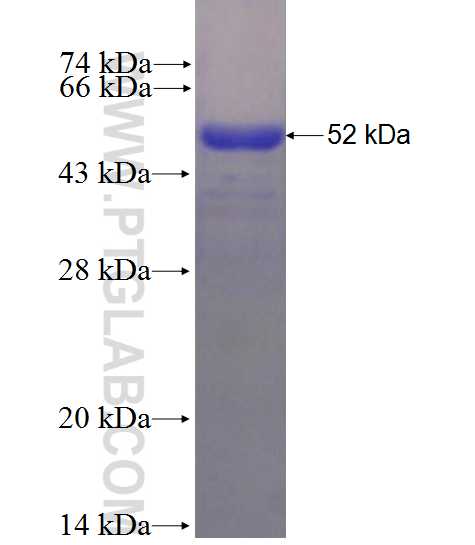 CX3CL1 fusion protein Ag0161 SDS-PAGE