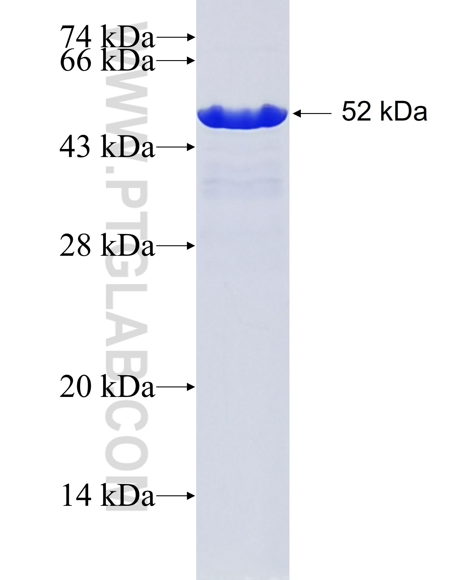 CX3CL1 fusion protein Ag0161 SDS-PAGE