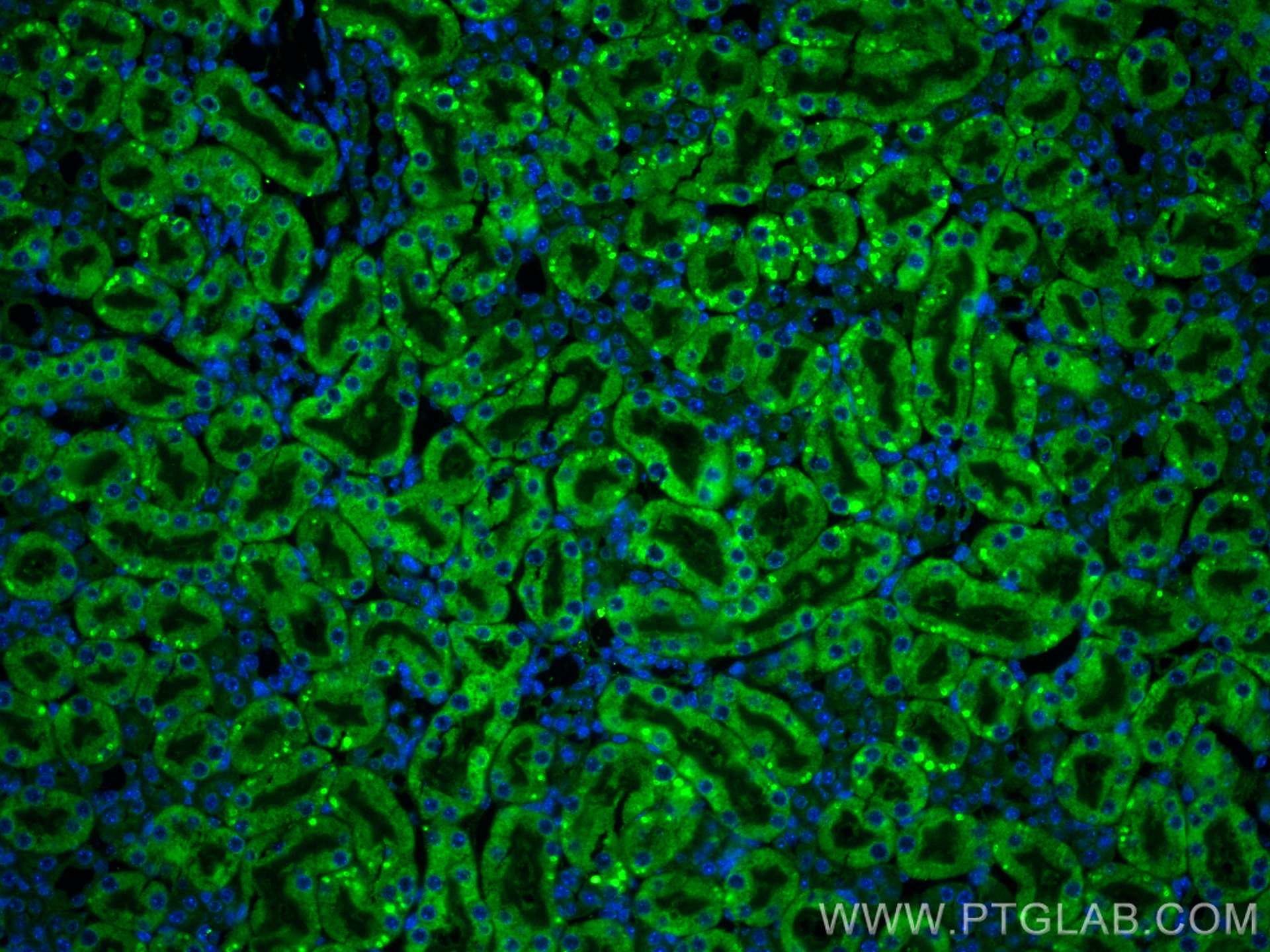 Immunofluorescence (IF) / fluorescent staining of mouse kidney tissue using CX3CR1 Polyclonal antibody (13885-1-AP)