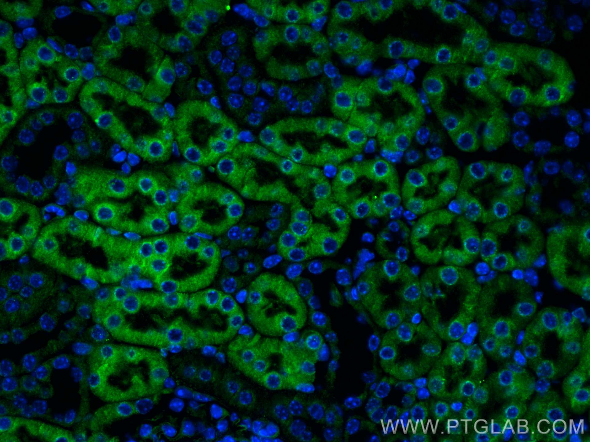 Immunofluorescence (IF) / fluorescent staining of mouse kidney tissue using CX3CR1 Polyclonal antibody (13885-1-AP)