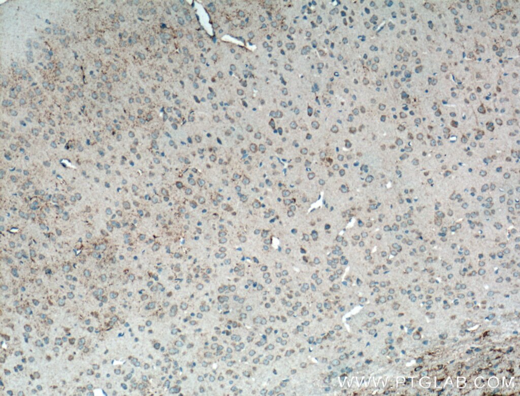 Immunohistochemistry (IHC) staining of mouse brain tissue using CX3CR1 Polyclonal antibody (13885-1-AP)