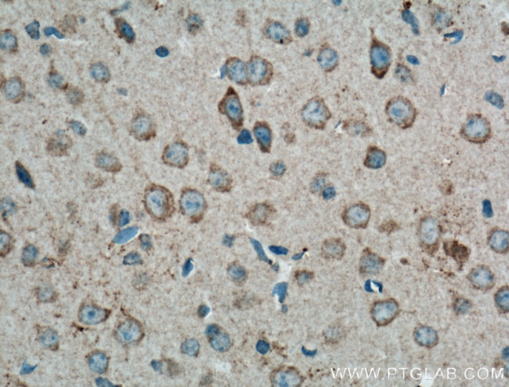 Immunohistochemistry (IHC) staining of mouse brain tissue using CX3CR1 Polyclonal antibody (13885-1-AP)