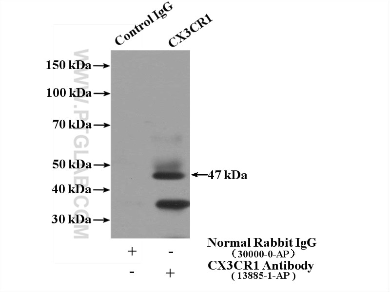 Immunoprecipitation (IP) experiment of SH-SY5Y cells using CX3CR1 Polyclonal antibody (13885-1-AP)