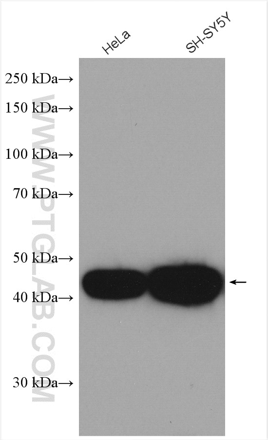 Western Blot (WB) analysis of various lysates using CX3CR1 Polyclonal antibody (13885-1-AP)