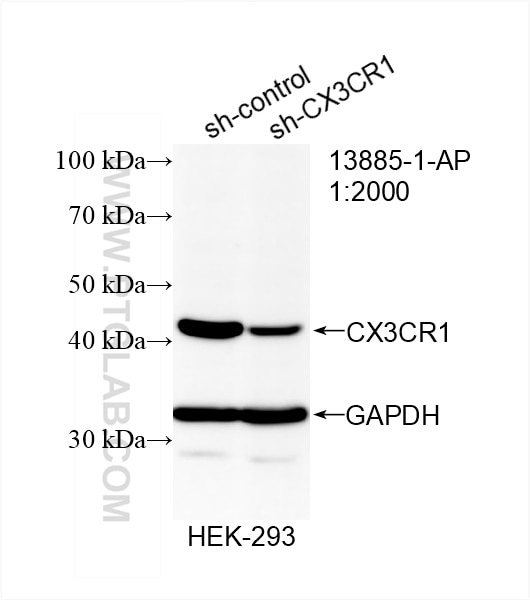 Western Blot (WB) analysis of HEK-293 cells using CX3CR1 Polyclonal antibody (13885-1-AP)