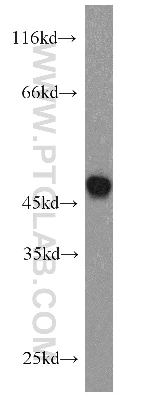 Western Blot (WB) analysis of HL-60 cells using CX3CR1 Polyclonal antibody (13885-1-AP)