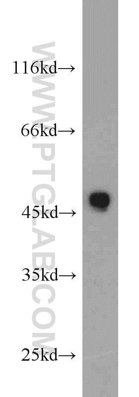 Western Blot (WB) analysis of SH-SY5Y cells using CX3CR1 Polyclonal antibody (13885-1-AP)