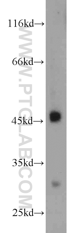 Western Blot (WB) analysis of U-937 cells using CX3CR1 Polyclonal antibody (13885-1-AP)