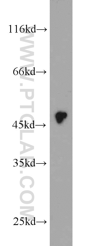 Western Blot (WB) analysis of K-562 cells using CX3CR1 Polyclonal antibody (13885-1-AP)