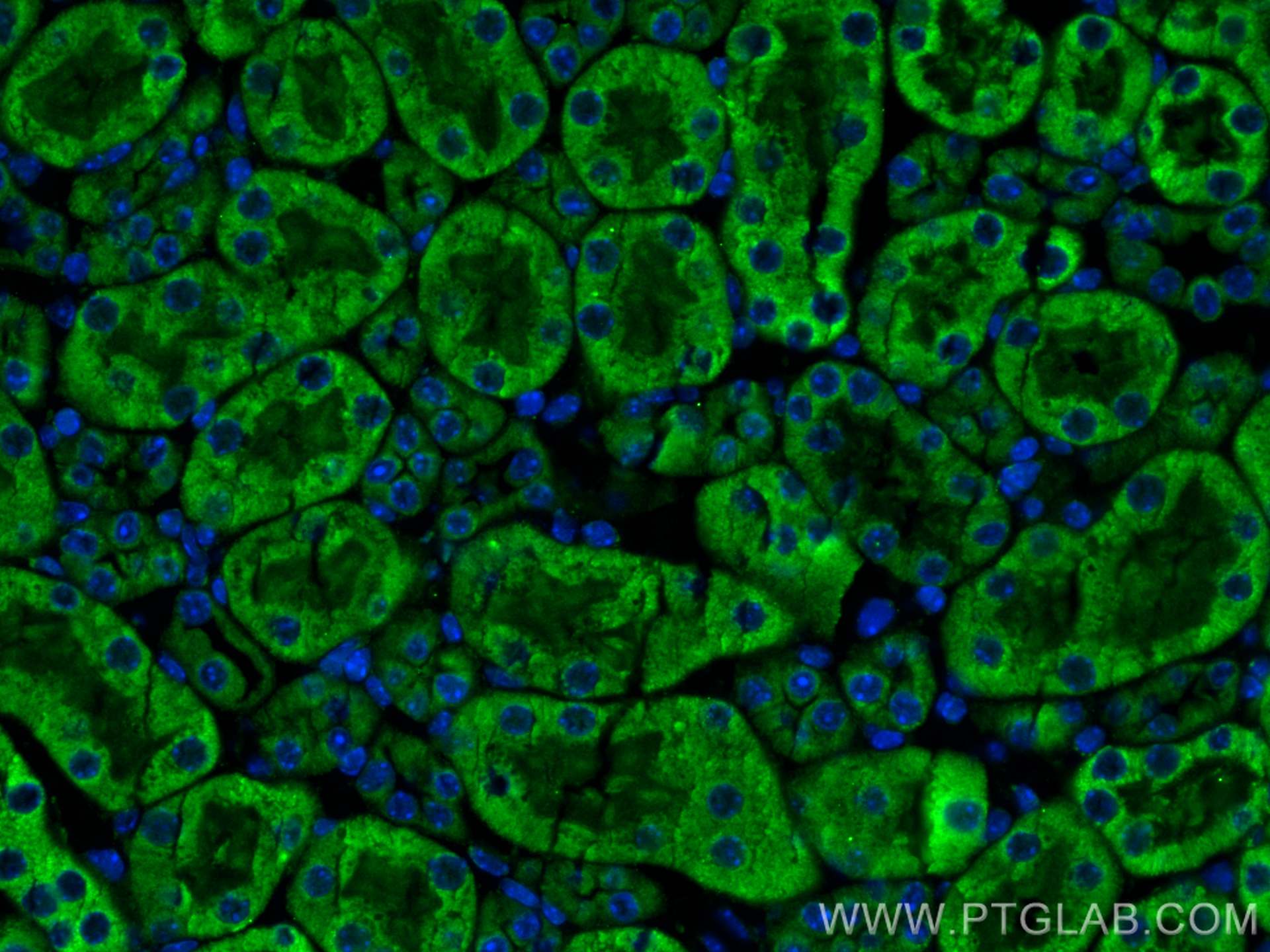 Immunofluorescence (IF) / fluorescent staining of mouse kidney tissue using CX3CR1 Polyclonal antibody (29819-1-AP)