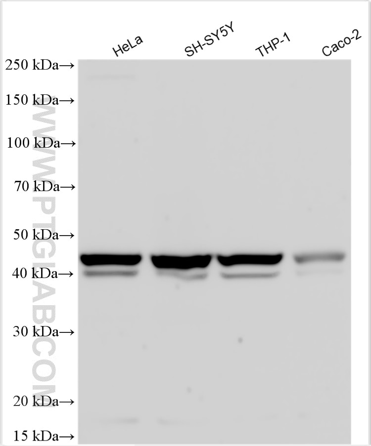 Western Blot (WB) analysis of various lysates using CX3CR1 Polyclonal antibody (29819-1-AP)