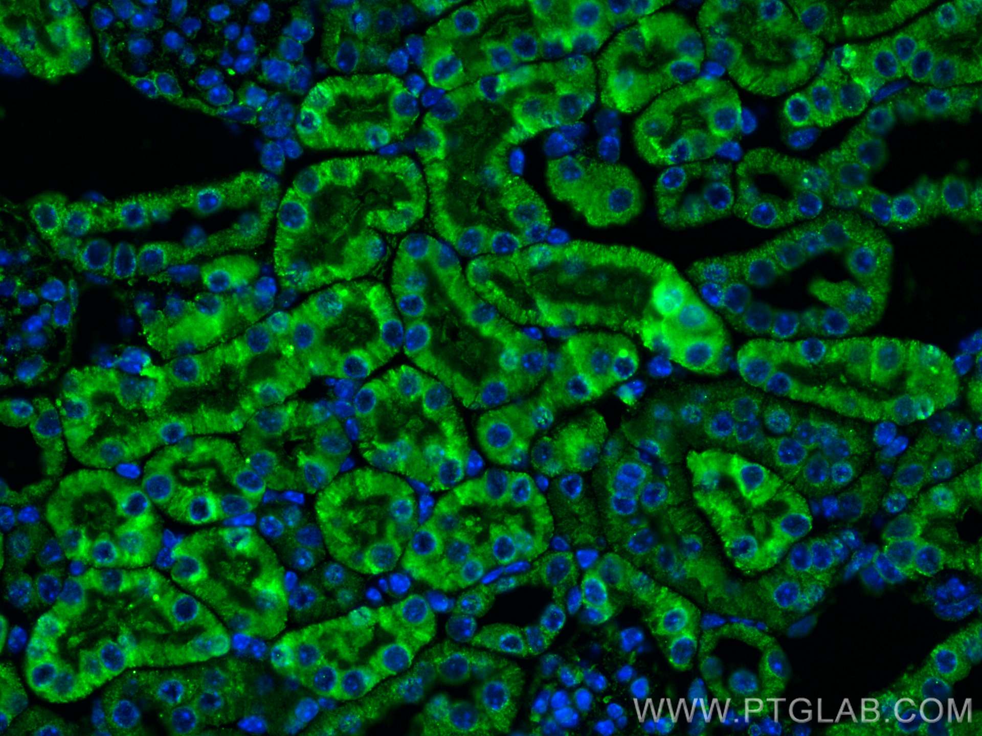 Immunofluorescence (IF) / fluorescent staining of mouse kidney tissue using CX3CR1 Monoclonal antibody (66915-1-Ig)