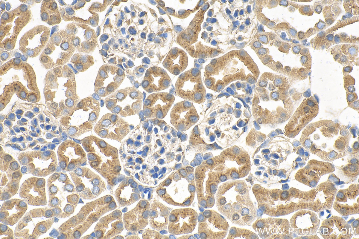 Immunohistochemistry (IHC) staining of mouse kidney tissue using CX3CR1 Monoclonal antibody (66915-1-Ig)