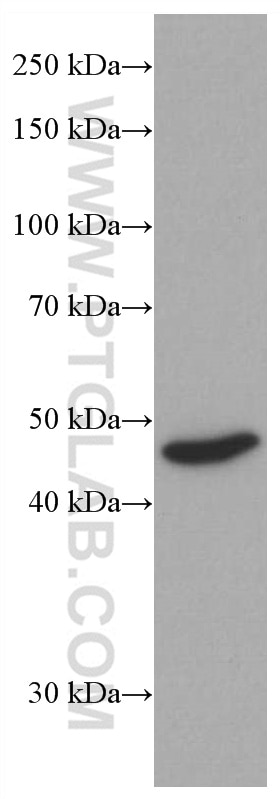 Western Blot (WB) analysis of Jurkat cells using CX3CR1 Monoclonal antibody (66915-1-Ig)