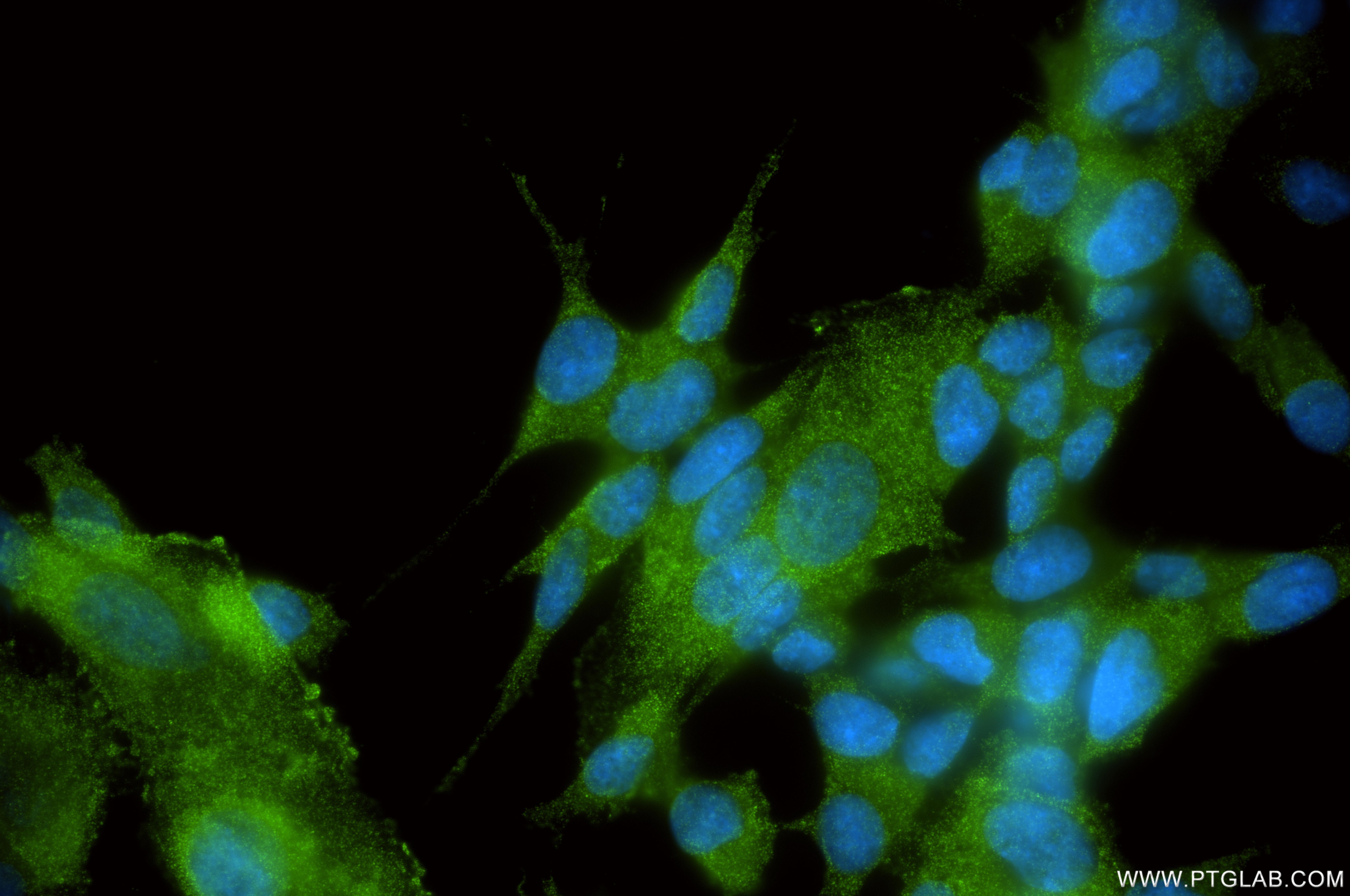 IF Staining of SH-SY5Y using 82183-2-RR (same clone as 82183-2-PBS) Immunofluorescence (IF) / fluorescent staining of SH-SY5Y cells using CX3CR1 Recombinant monoclonal antibody (82183-2-RR)