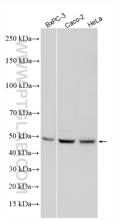 Western Blot (WB) analysis of various lysates using CXADR Polyclonal antibody (11777-1-AP)