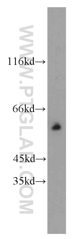 Western Blot (WB) analysis of mouse heart tissue using CXADR Polyclonal antibody (11777-1-AP)
