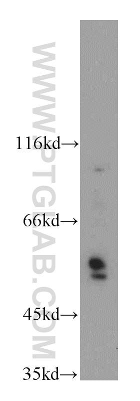Western Blot (WB) analysis of mouse small intestine tissue using CXADR Polyclonal antibody (11777-1-AP)