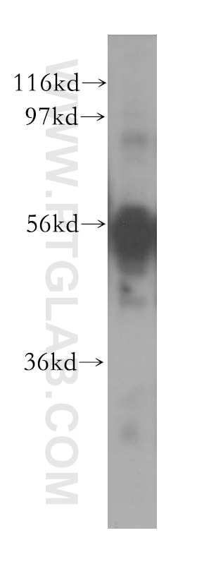 Western Blot (WB) analysis of BxPC-3 cells using CXADR Polyclonal antibody (11777-1-AP)