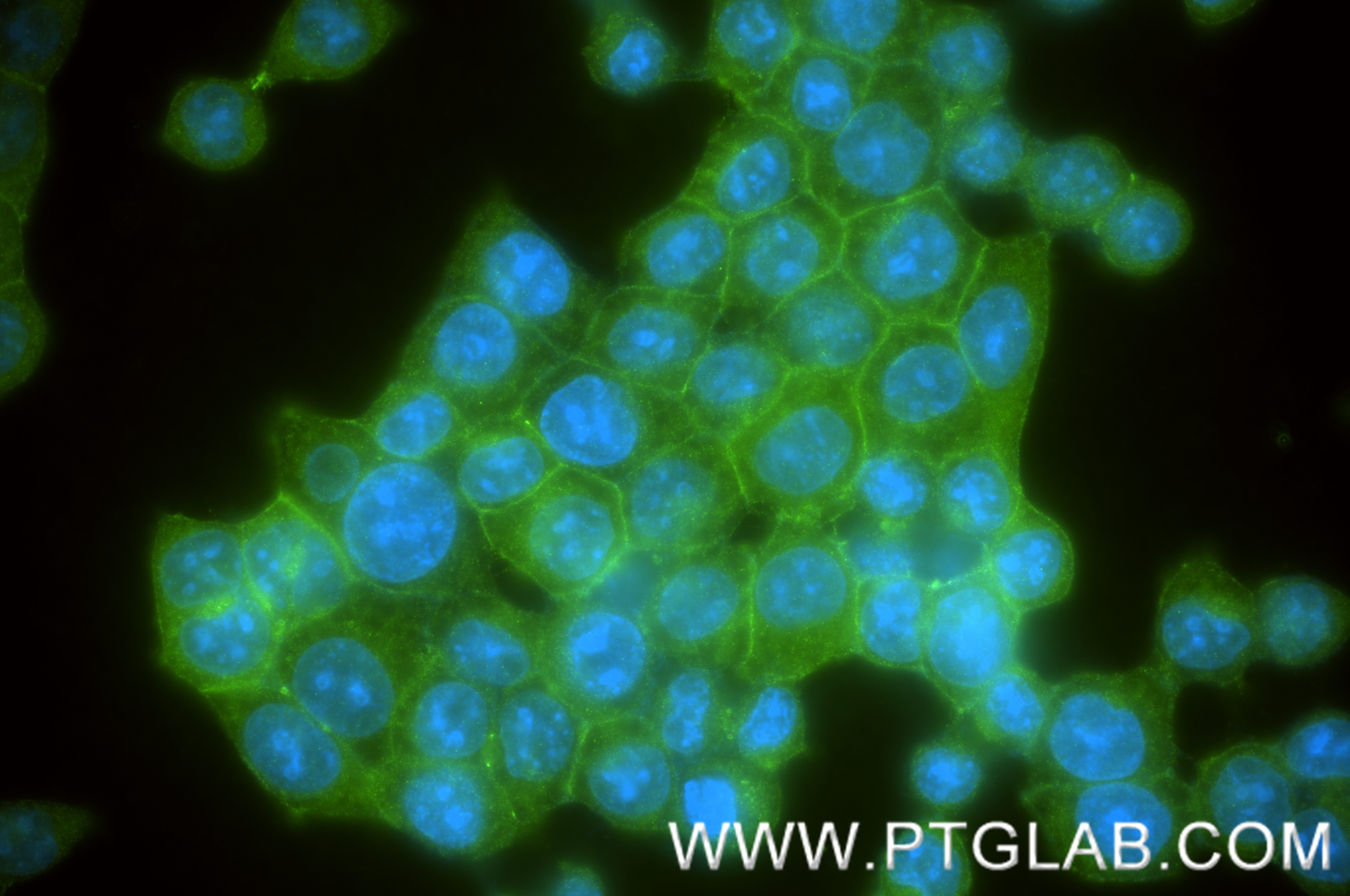 IF Staining of BxPC-3 using 86186-1-RR Immunofluorescence (IF) / fluorescent staining of BxPC-3 cells using CXADR Recombinant monoclonal antibody (86186-1-RR)