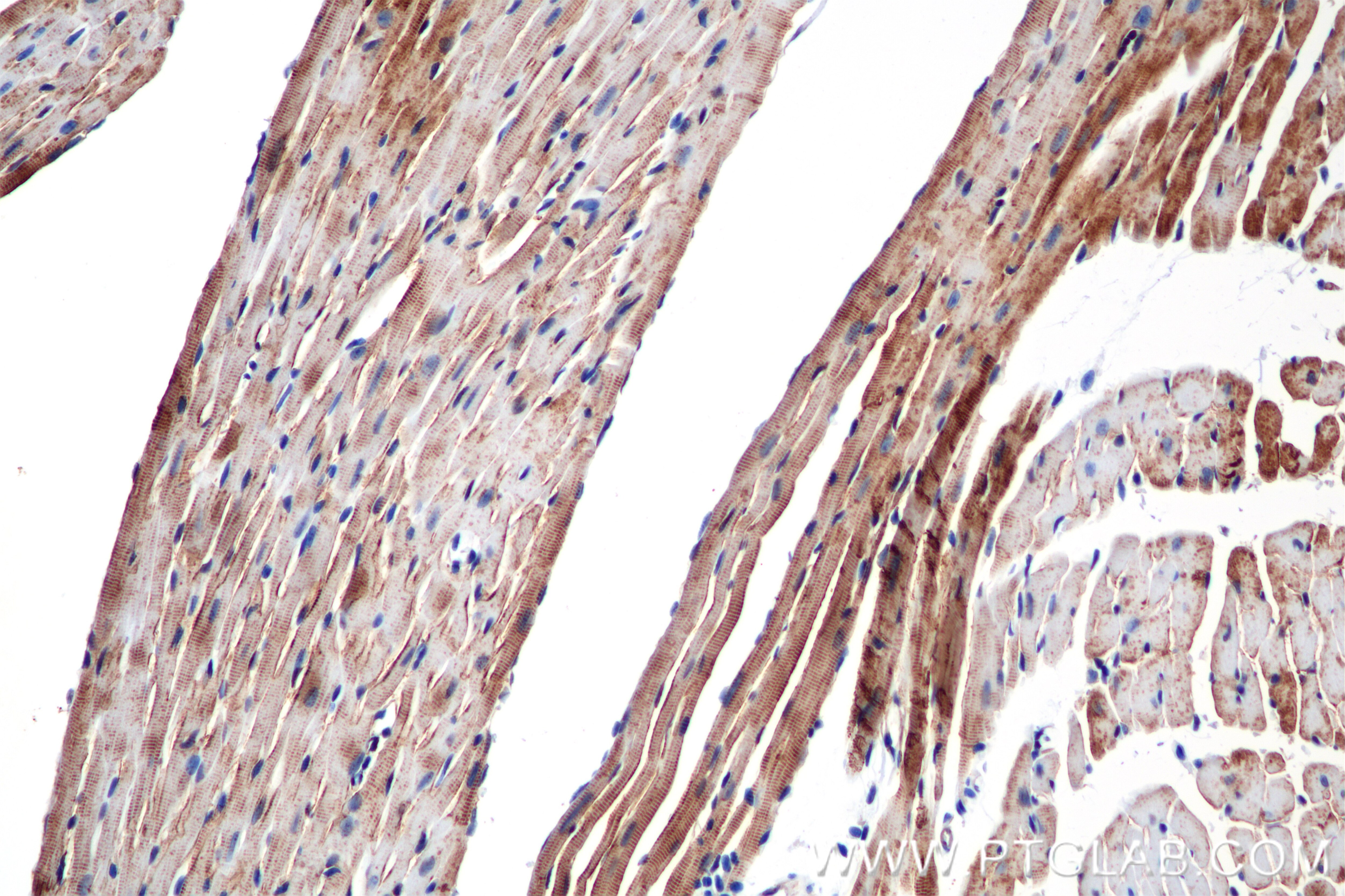 Immunohistochemistry (IHC) staining of mouse heart tissue using CXADR Recombinant antibody (86186-1-RR)
