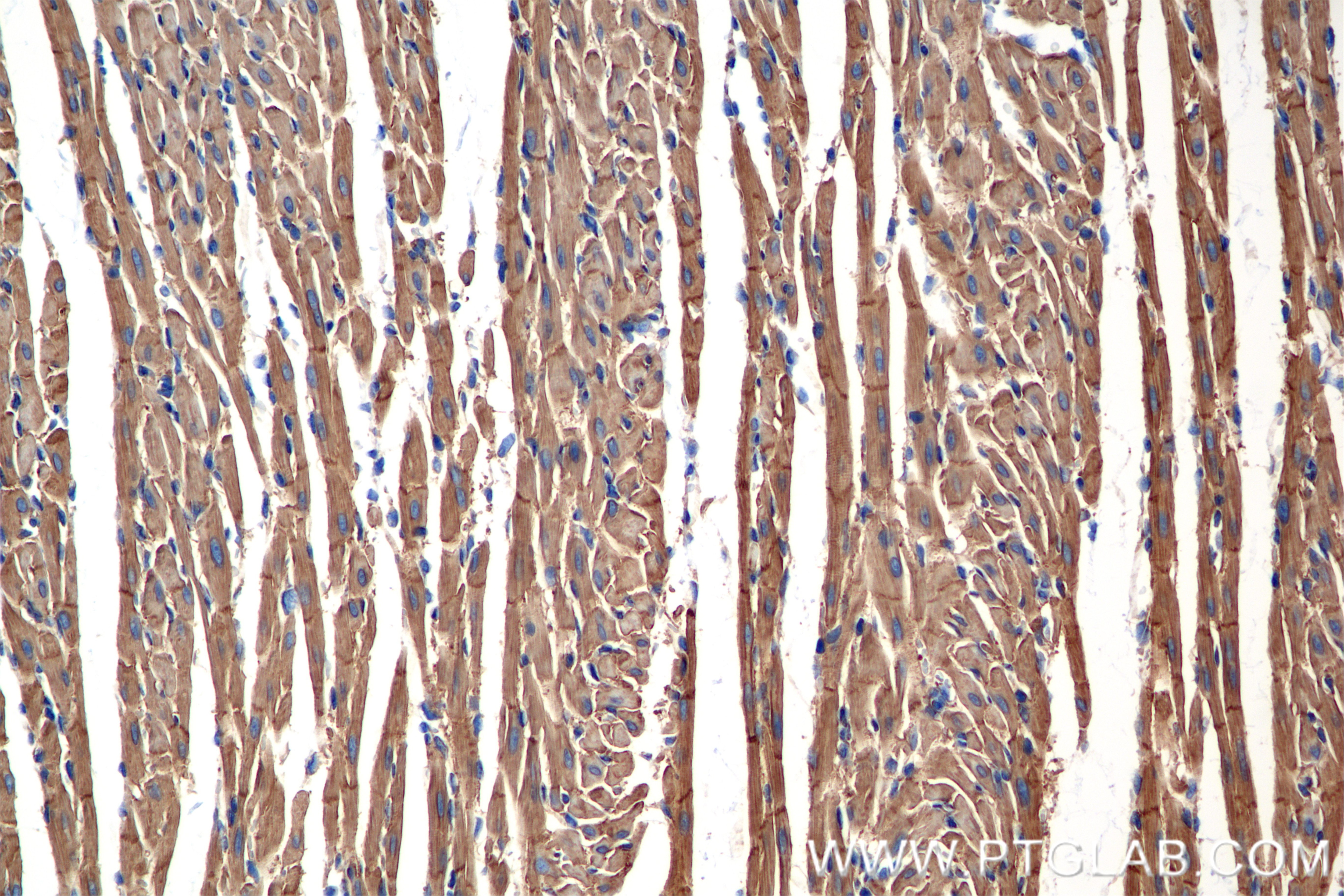 Immunohistochemistry (IHC) staining of rat heart tissue using CXADR Recombinant antibody (86186-1-RR)