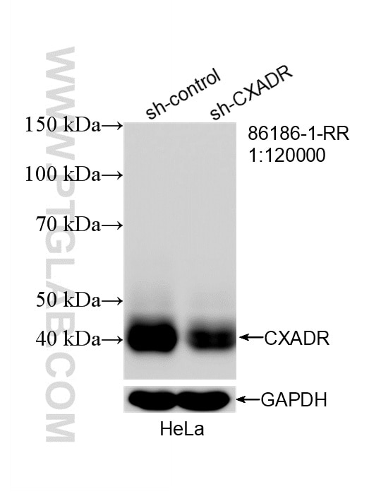 Western Blot (WB) analysis of HeLa cells using CXADR Recombinant monoclonal antibody (86186-1-RR)