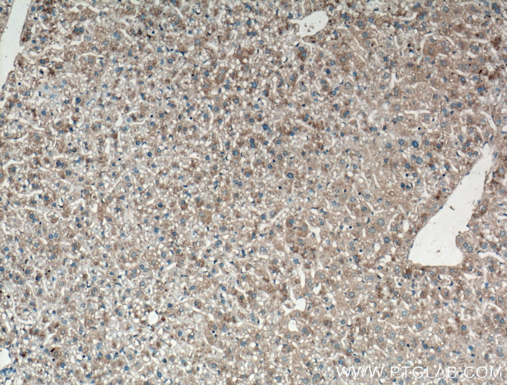 IHC staining of mouse liver using 12335-1-AP