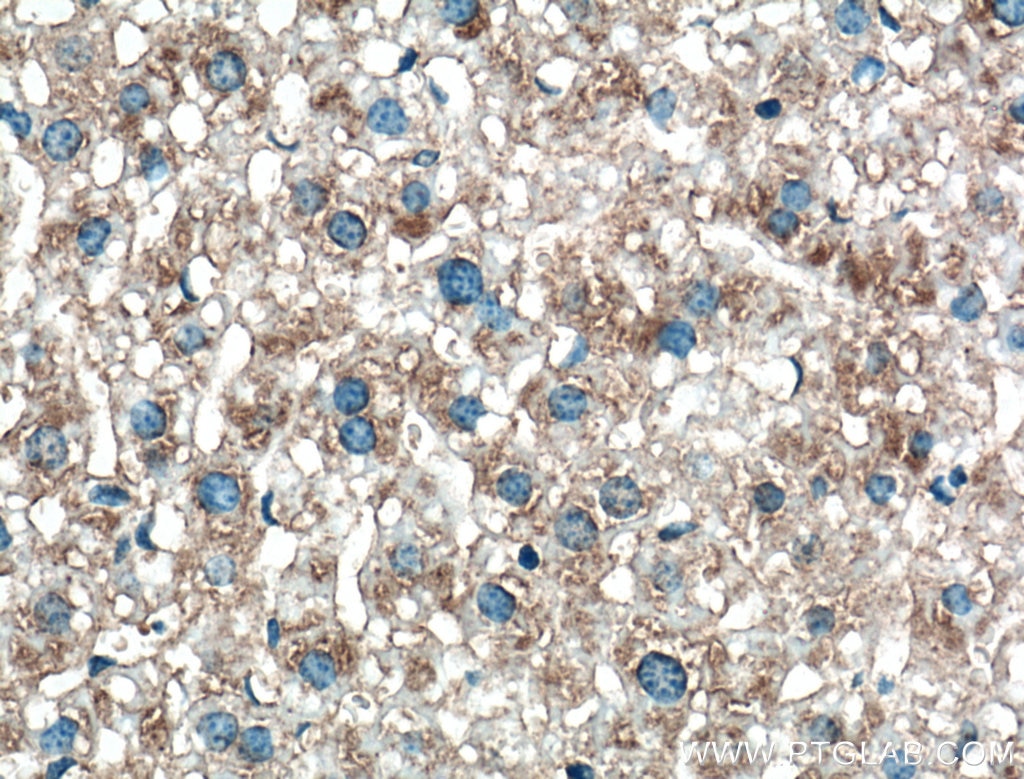 IHC staining of mouse liver using 12335-1-AP