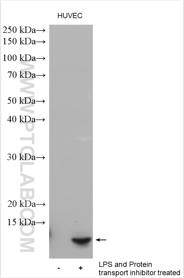 Western Blot (WB) analysis of various lysates using CXCL1 Polyclonal antibody (12335-1-AP)