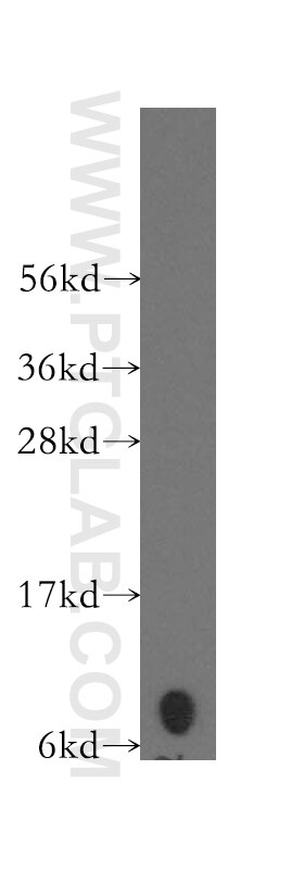 CXCL1 Polyclonal antibody