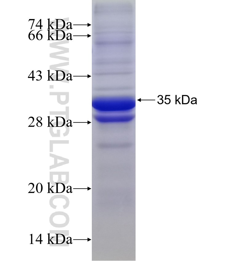 CXCL1 fusion protein Ag2917 SDS-PAGE