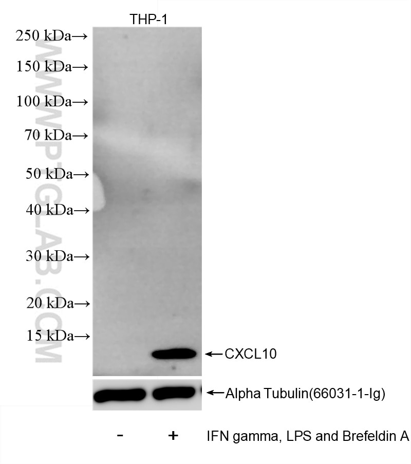 CXCL10/IP-10