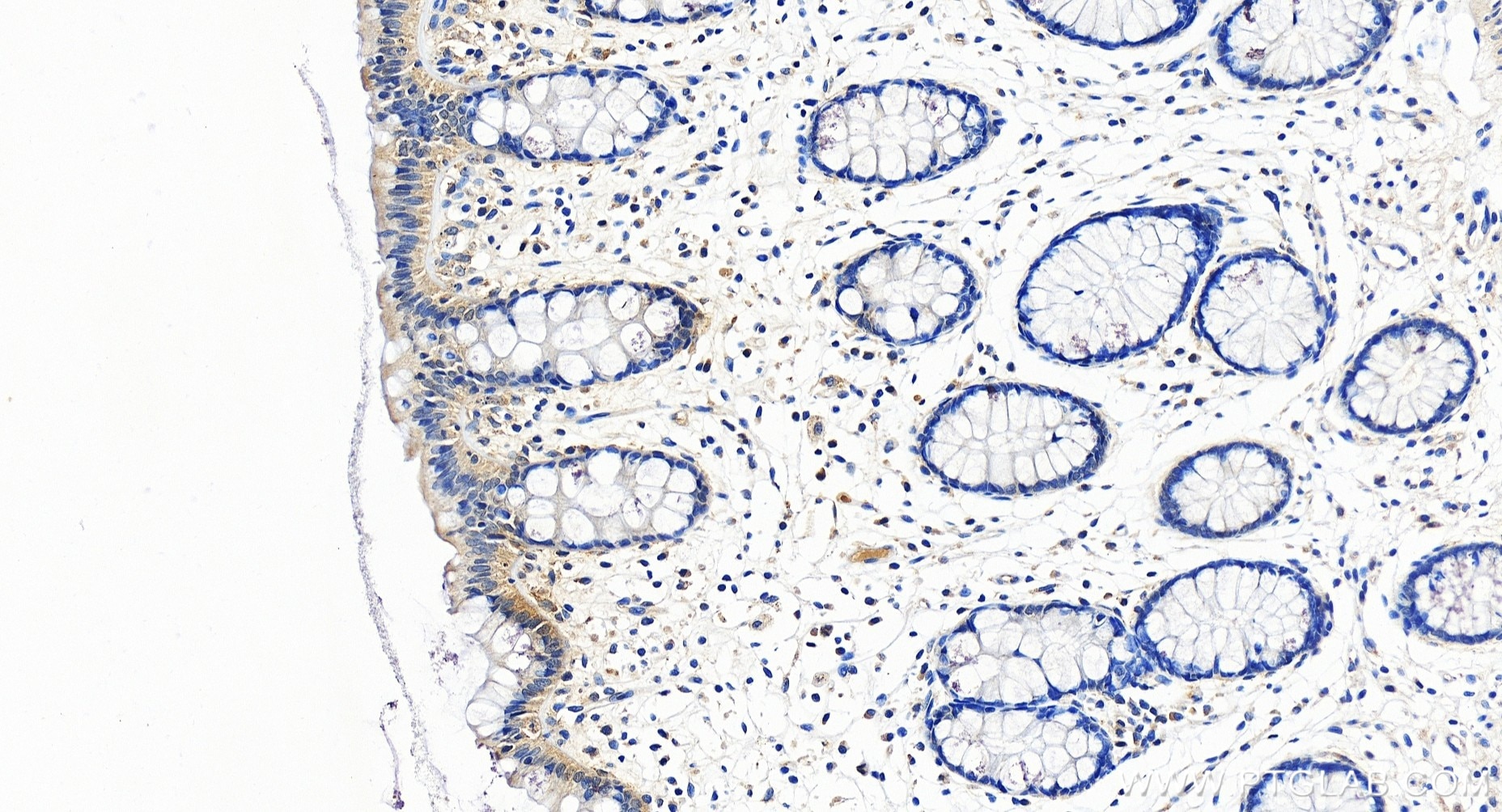 Immunohistochemistry (IHC) staining of human colon tissue using CXCL10/IP-10 Recombinant antibody (85307-1-RR)