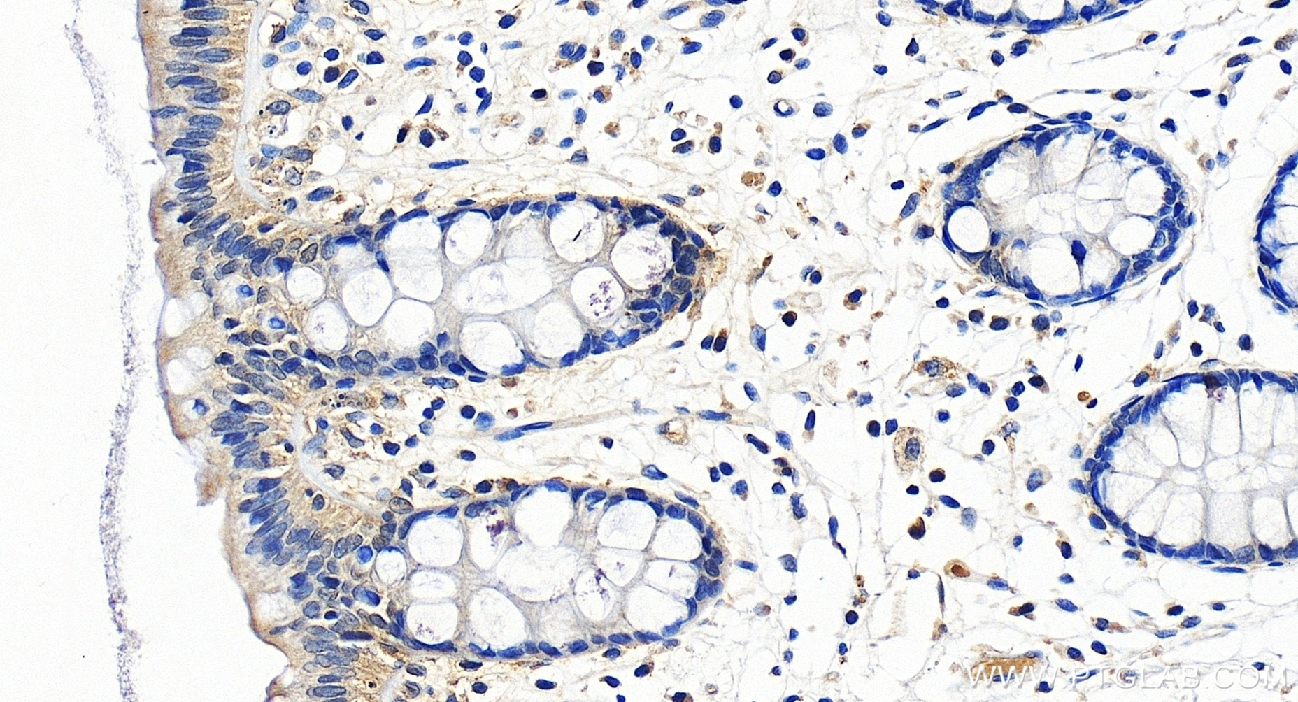 Immunohistochemistry (IHC) staining of human colon tissue using CXCL10/IP-10 Recombinant antibody (85307-1-RR)