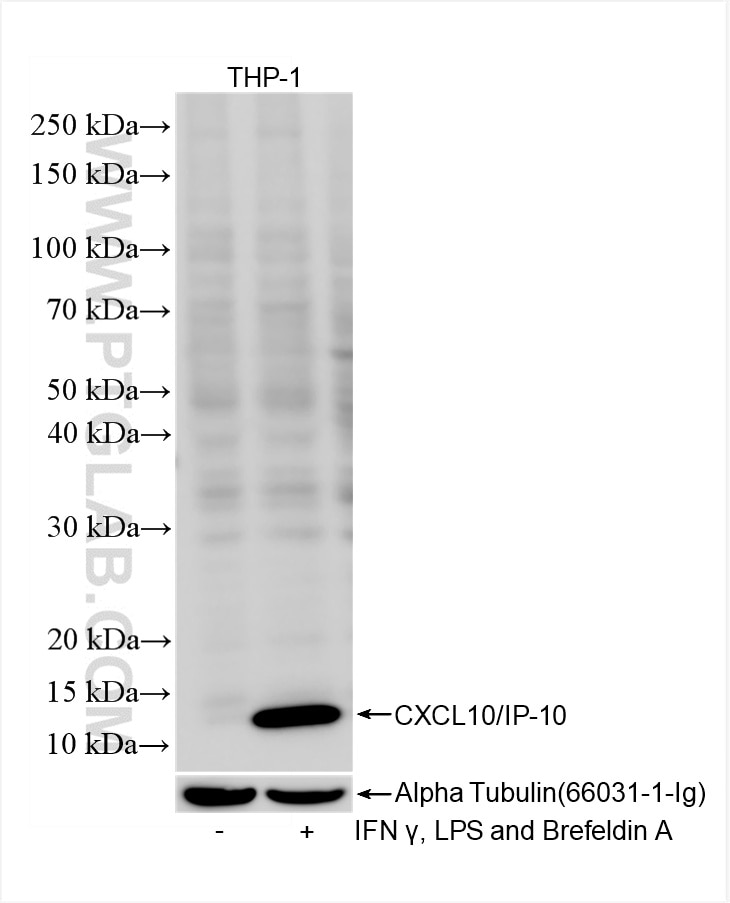 CXCL10/IP-10