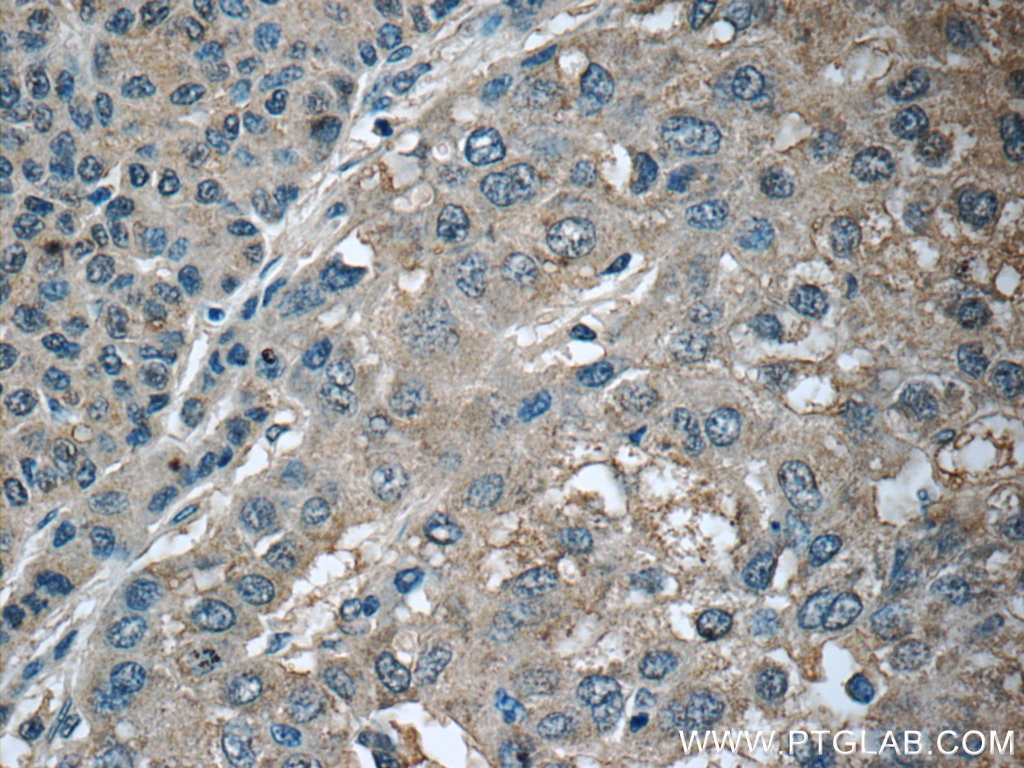 CXCL12/SDF-1 Polyclonal antibody