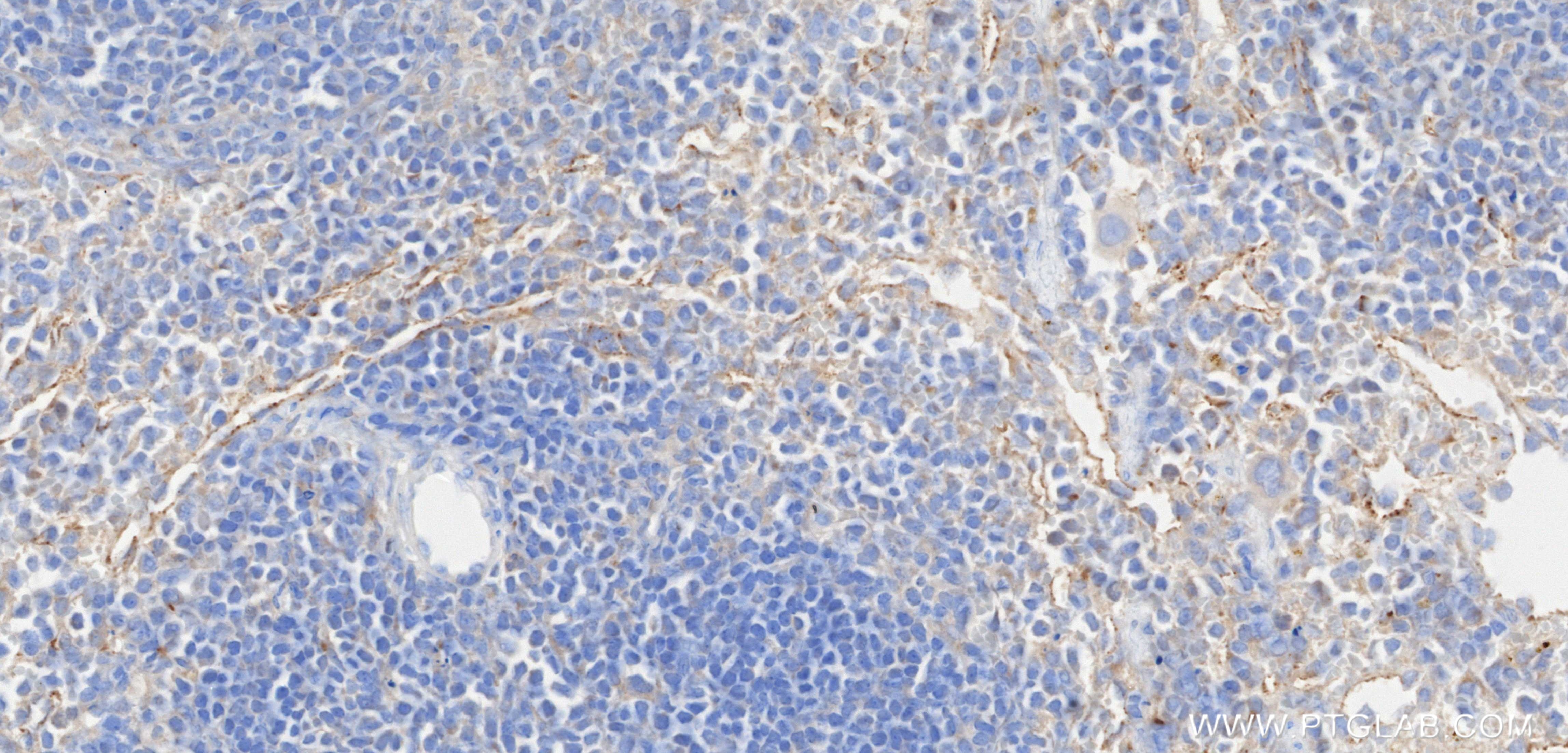Immunohistochemistry (IHC) staining of mouse spleen tissue using CXCL12/SDF-1 Recombinant monoclonal antibody (87669-1-RR)