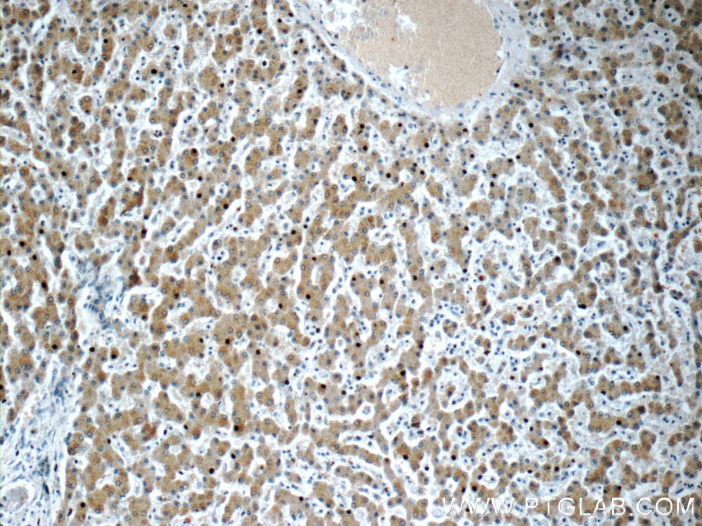 Immunohistochemistry (IHC) staining of human liver tissue using CXCL13/BCA1 Polyclonal antibody (10927-1-AP)