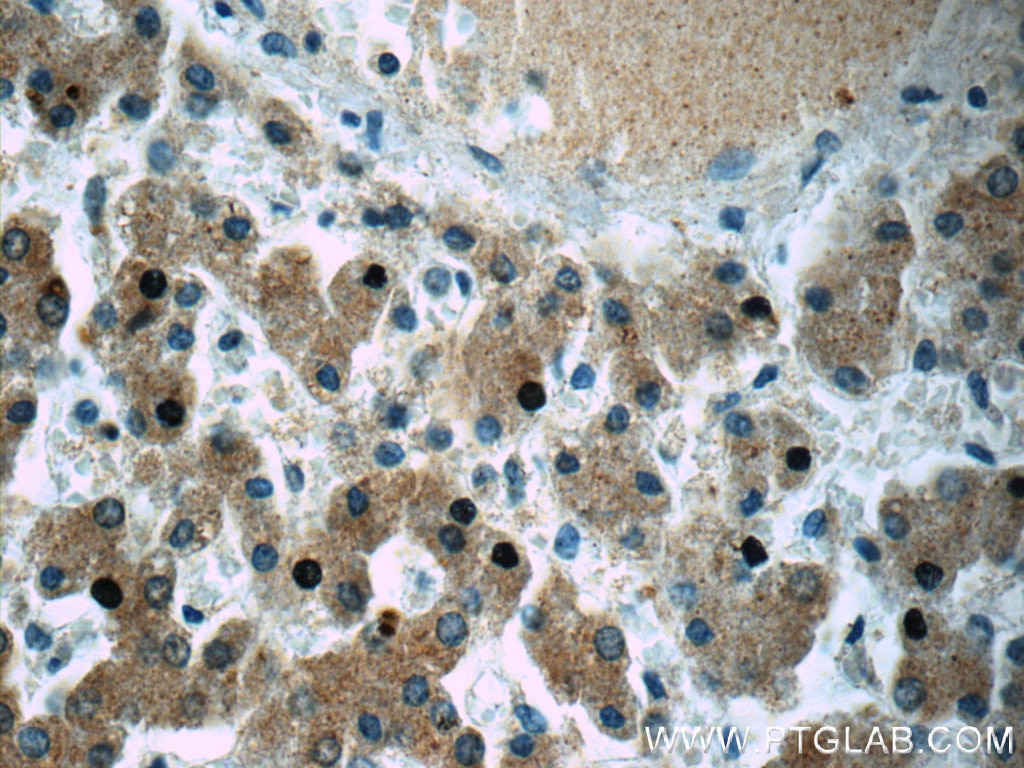 Immunohistochemistry (IHC) staining of human liver tissue using CXCL13/BCA1 Polyclonal antibody (10927-1-AP)