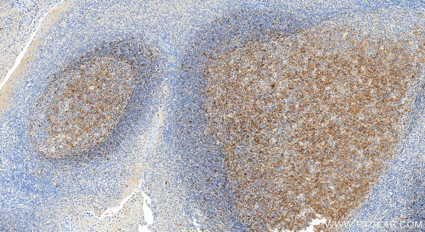 IHC staining of human tonsillitis using 10927-1-AP Immunohistochemistry (IHC) staining of human tonsillitis tissue using CXCL13/BCA1 Polyclonal antibody (10927-1-AP)