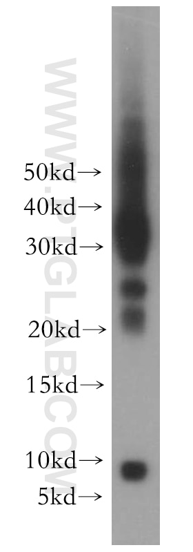 Western Blot (WB) analysis of human plasma using CXCL13/BCA1 Polyclonal antibody (10927-1-AP)