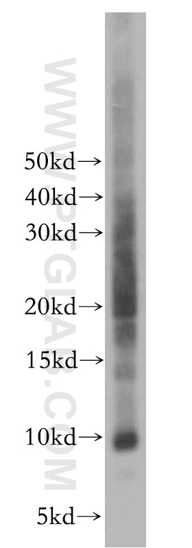 Western Blot (WB) analysis of Jurkat cells using CXCL13/BCA1 Polyclonal antibody (10927-1-AP)