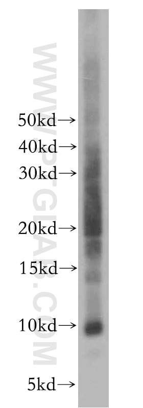 WB analysis of Jurkat using 10927-1-AP
