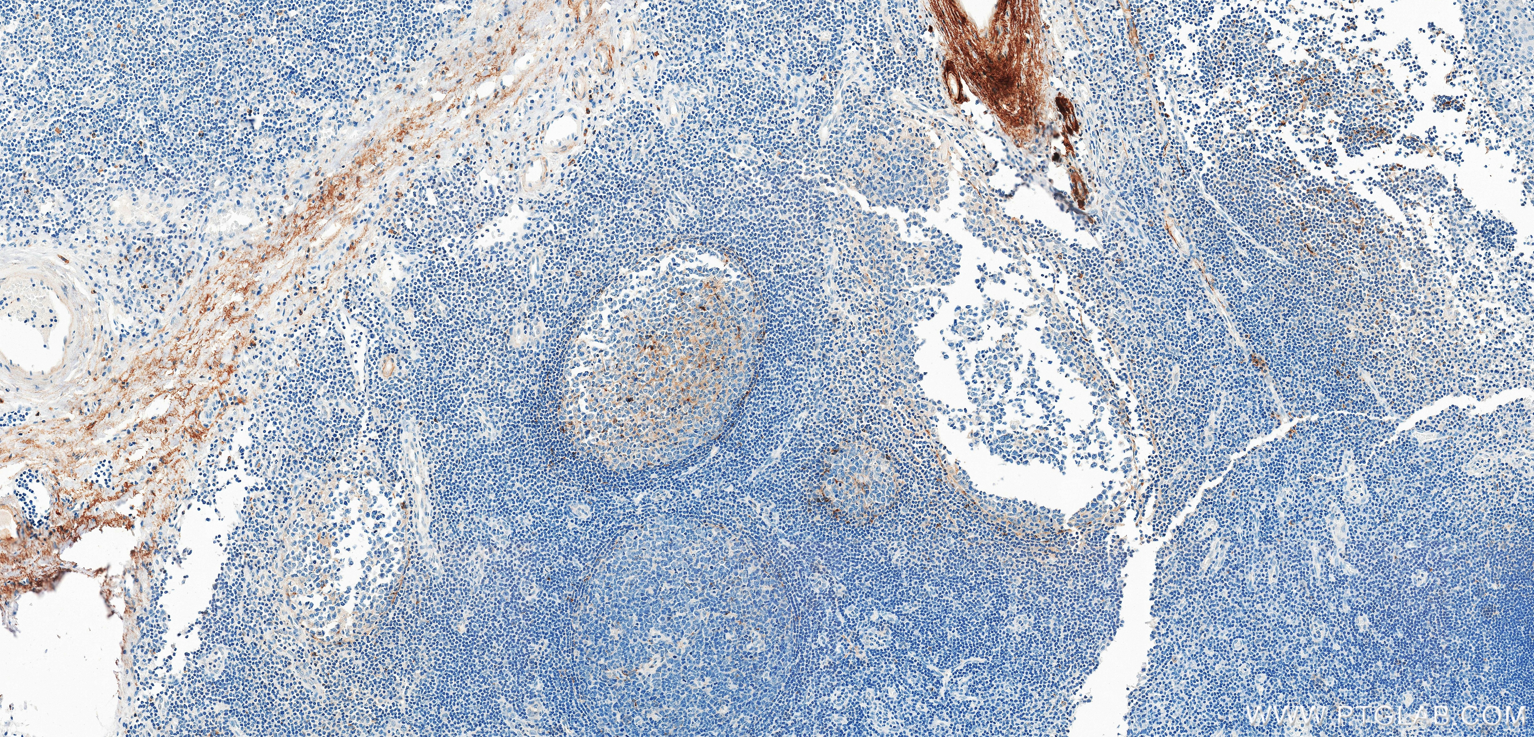 Immunohistochemistry (IHC) staining of human tonsillitis tissue using CXCL13/BCA1 Recombinant monoclonal antibody (87928-3-RR)