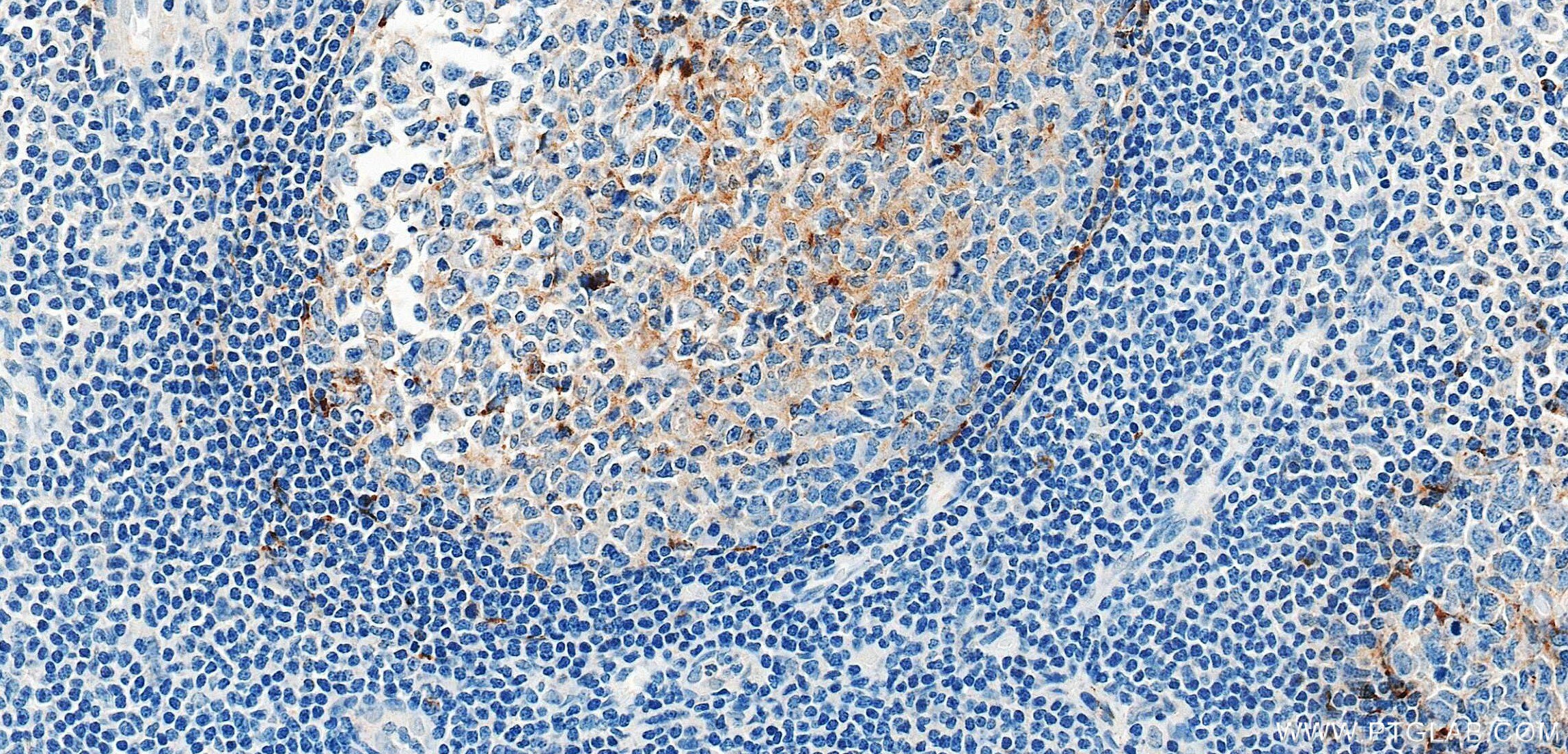 Immunohistochemistry (IHC) staining of human tonsillitis tissue using CXCL13/BCA1 Recombinant monoclonal antibody (87928-3-RR)