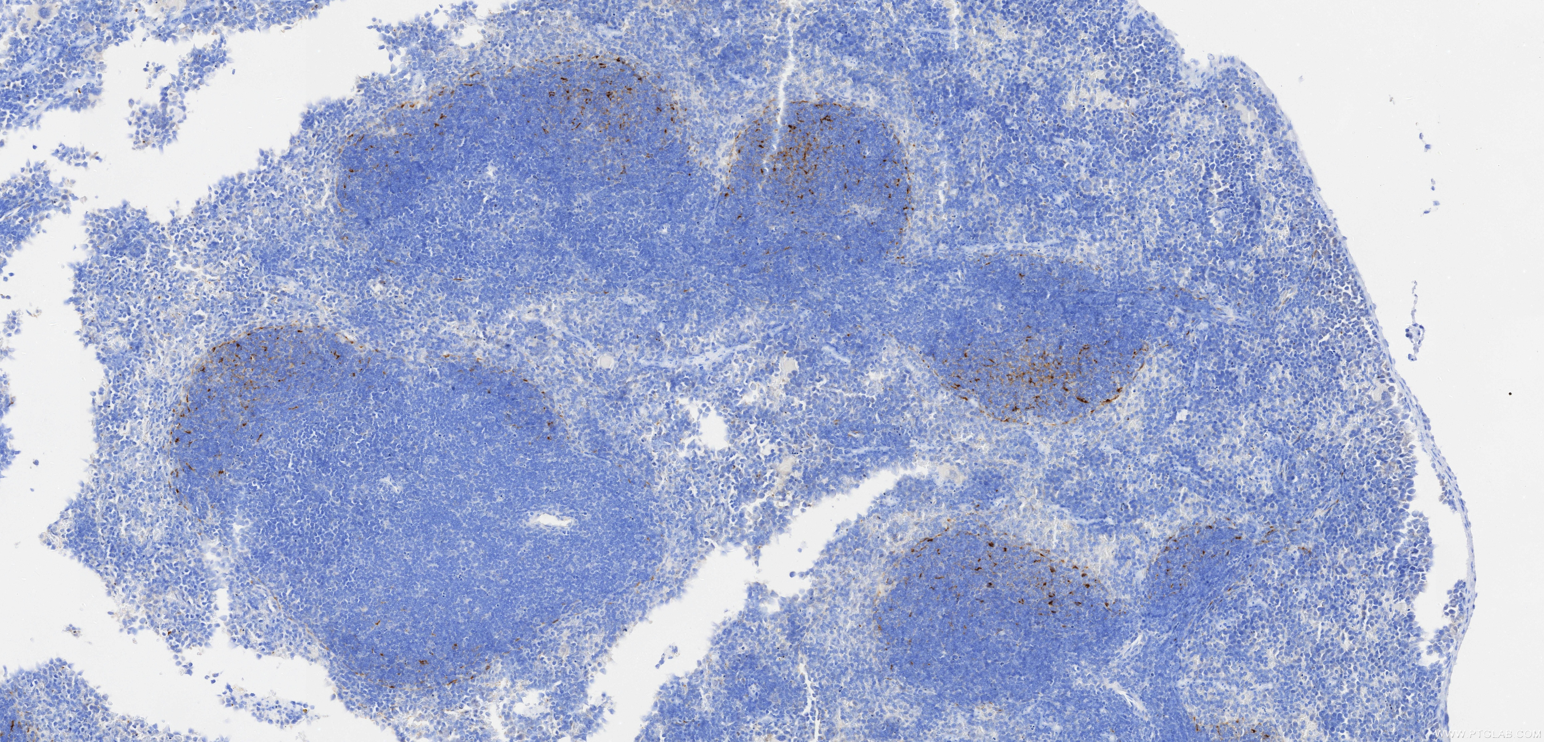 Immunohistochemistry (IHC) staining of mouse spleen tissue using Anti-Mouse CXCL13/BCA1 Rabbit Recombinant Antibody (98562-1-RR)