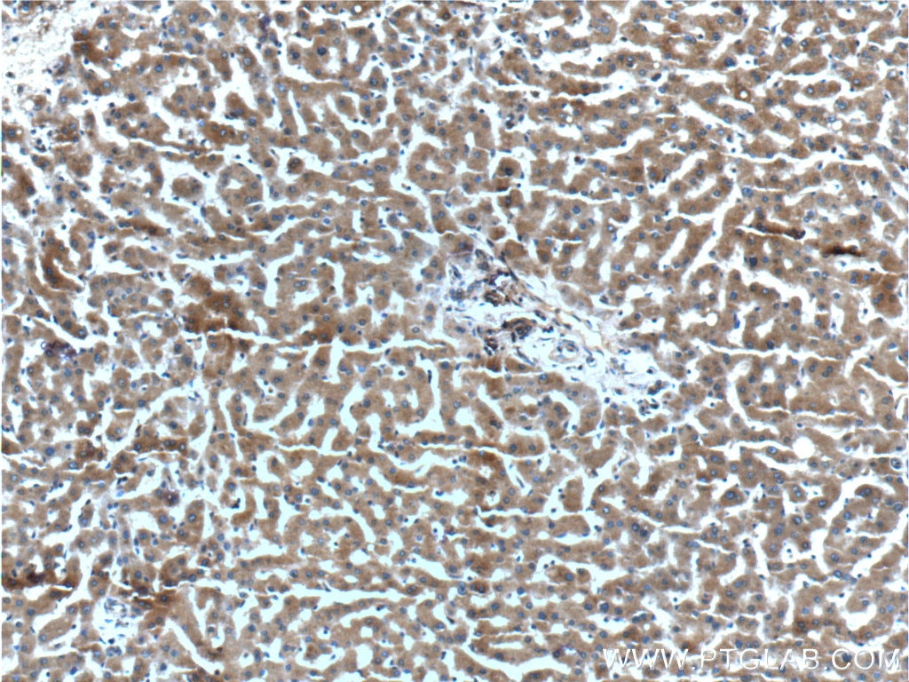 Immunohistochemistry (IHC) staining of human liver tissue using CXCL14 Polyclonal antibody (10468-1-AP)